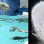 மூடநம்பிக்கையின் உச்சம்… ஆண் குழந்தைக்காக கர்ப்பிணி பெண்ணின் தலையில் ஆணி அடித்த சாமியார்