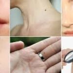 உங்களுக்கு இந்த இடங்களில் மச்சம் இருக்கா!