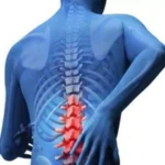 முதுகுவலியைப் போக்க சில மருத்துவக்குறிப்பு