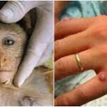 மேலும் 3 நாடுகளில் உறுதி செய்யப்பட்ட குரங்கம்மை தொற்று