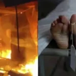 யாழ் தீ விபத்தில் சிறுமி உயிரிழப்பு!